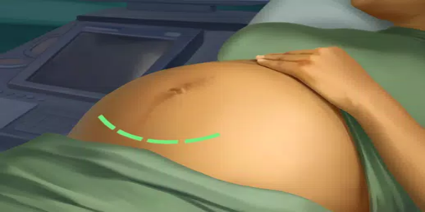 Patakbuhin ngayon: Ospital